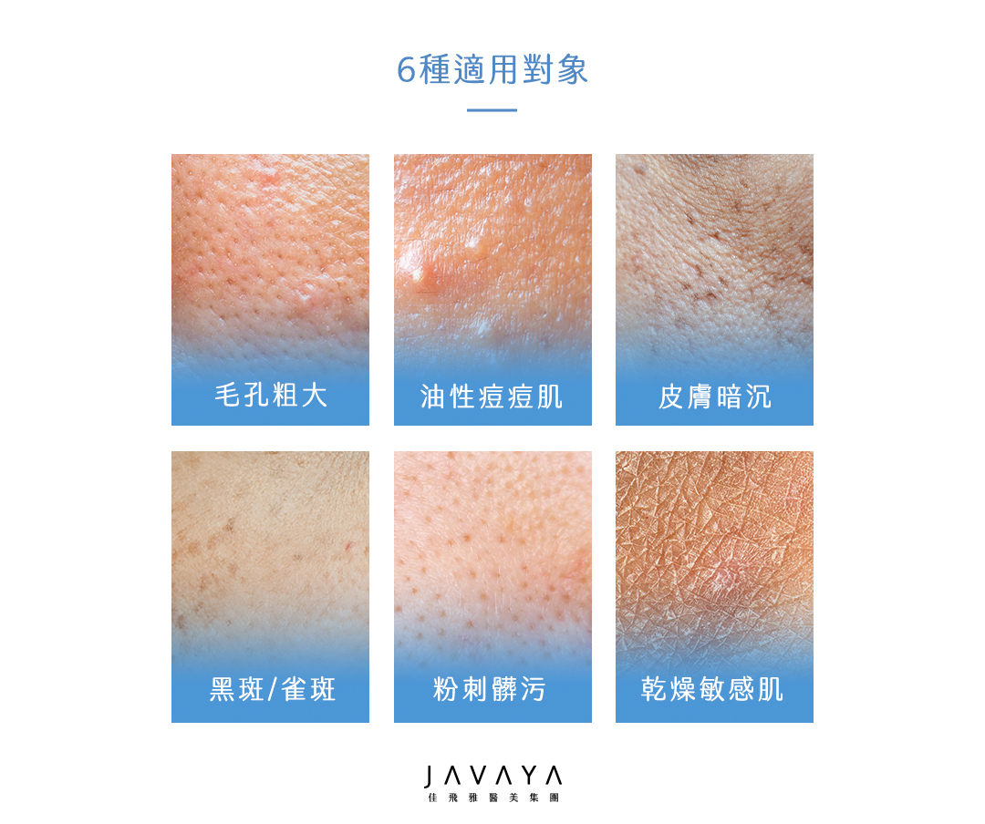 海菲秀的適用對象-1.毛孔粗大 2.肌膚暗沉 3.粉刺髒汙 4.油性痘痘肌 5.黑斑雀斑 6.乾燥敏感肌 | 佳飛雅醫美